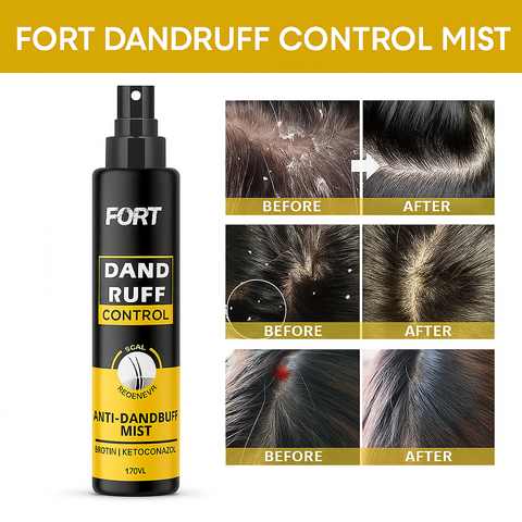 Dandruff Control Mist